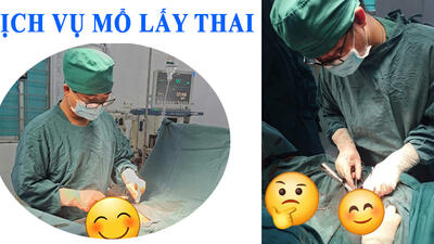 dịch vụ mổ lấy thai